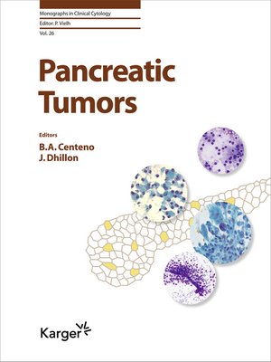cover image of Pancreatic Tumors